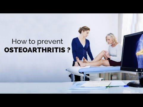 Matrix Gelenke kaufen Hip Osteophyten, was es ist