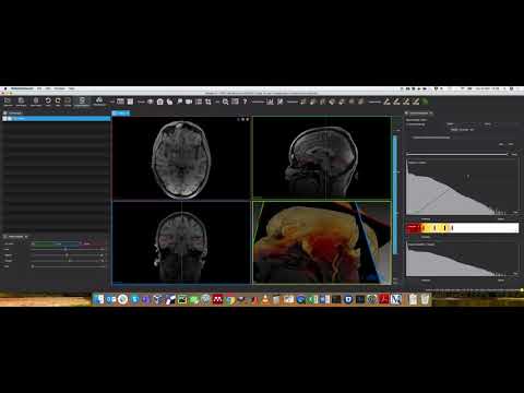 MPHY0026: Volume Rendering Functions