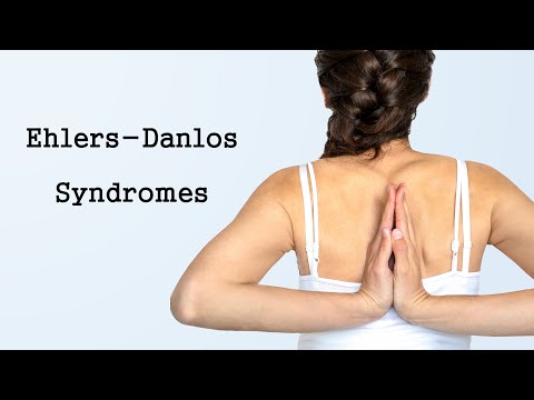 The Ehlers-Danlos Syndromes (EDS)