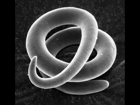 Trichinella férgek kezelése