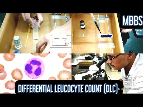 Differential Leucocyte Count (DLC) Practical | (MUHS) | #mbbs #physiology #hematology