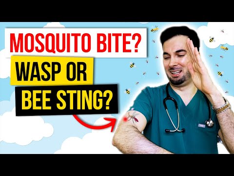 Hemorrhoids treatment at home naturally how to get rid of it