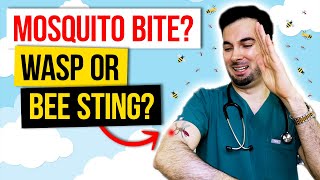 How to get rid of mosquito bites and insect treatment