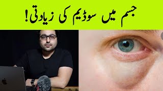 Dr. Zee:How To Get Rid of Puffy Eye bags? पानी या वसा?