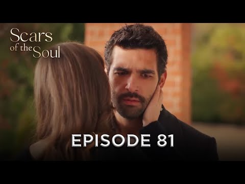 Scars of the Soul - Episode 81 | Alaca English Subtitles