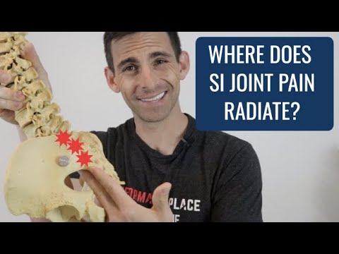 Where Does SI Joint Pain Radiate?