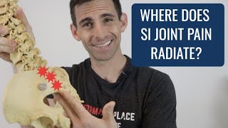 Where Does SI Joint Pain Radiate?