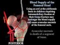 Avascular Necrosis, Blood Supply Femoral Head- Everything You Need To Know - Dr. Nabil Ebraheim