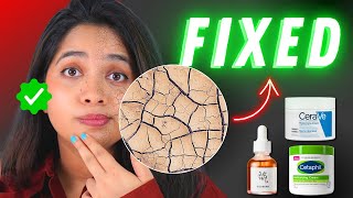 How To Fix Dry Skin in 3 Simple Steps!