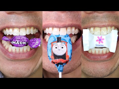 The ASMR Awakening: Unlocking the Secrets of March 30th, 2023 #DoctorTristanPeh #ASMR