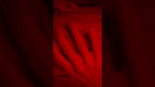 Teaser