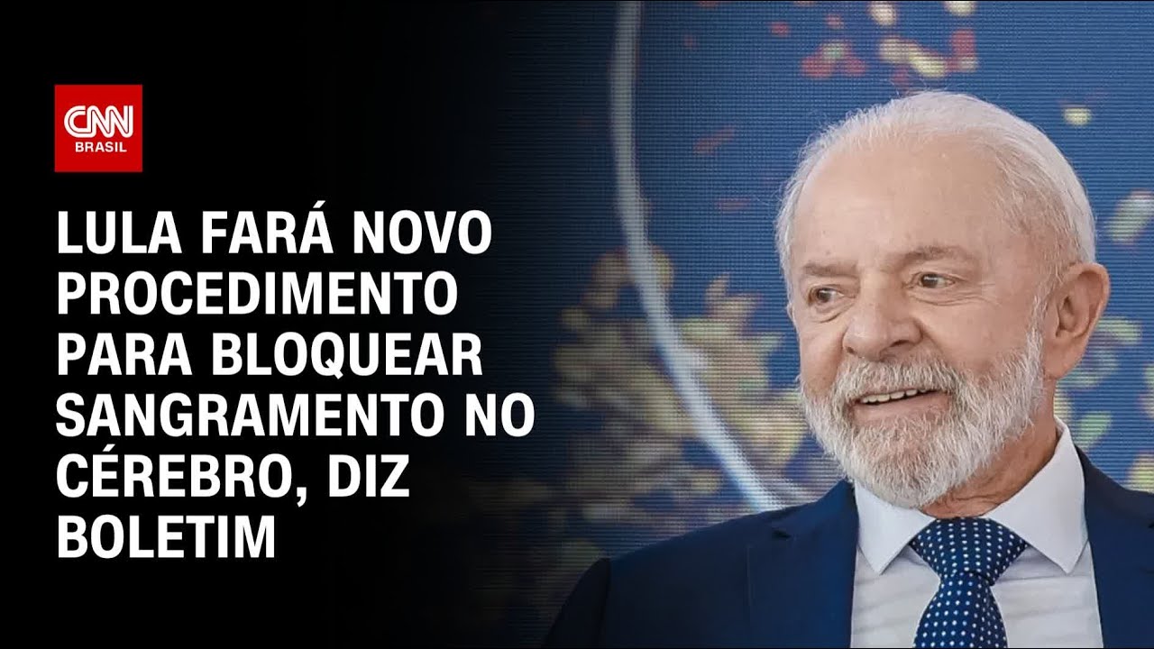 Lula fará novo procedimento para bloquear sangramento no cérebro, diz boletim | CNN 360º