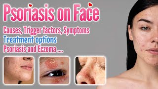 Psoriasis on Face Causes, Symptoms, Trigger Factors, Types, Contagiosity, and treatment options