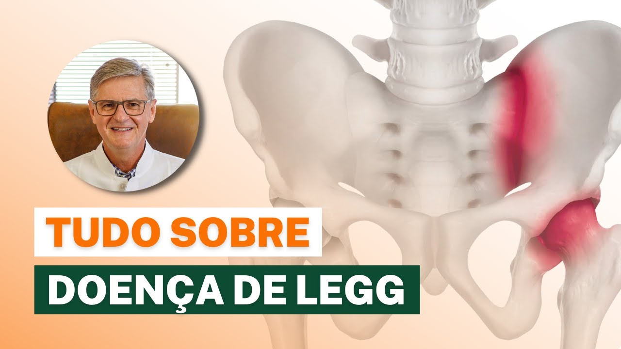Tudo sobre a Doença de Legg-Perthes