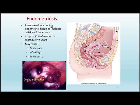 Reproductive Disorders