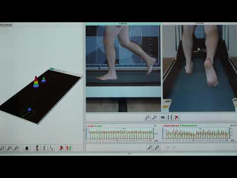 Knickfuß beim Laufen