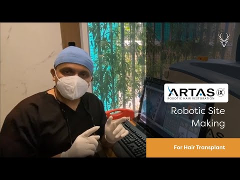 ARTAS 9x Robotic Site Making For Hair Transplant | Musk Clinic