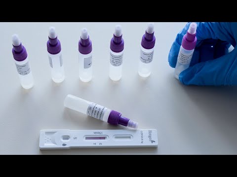 Angst vor Mutationen: Wichtige Corona-Kennziffer gestiegen