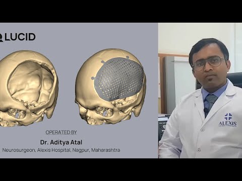 Latest Advancements in Cranioplasty Surgery