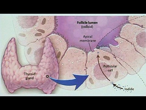 Sumunog sa tiyan taba sa gym Pagkain na sanhi ng cellulite