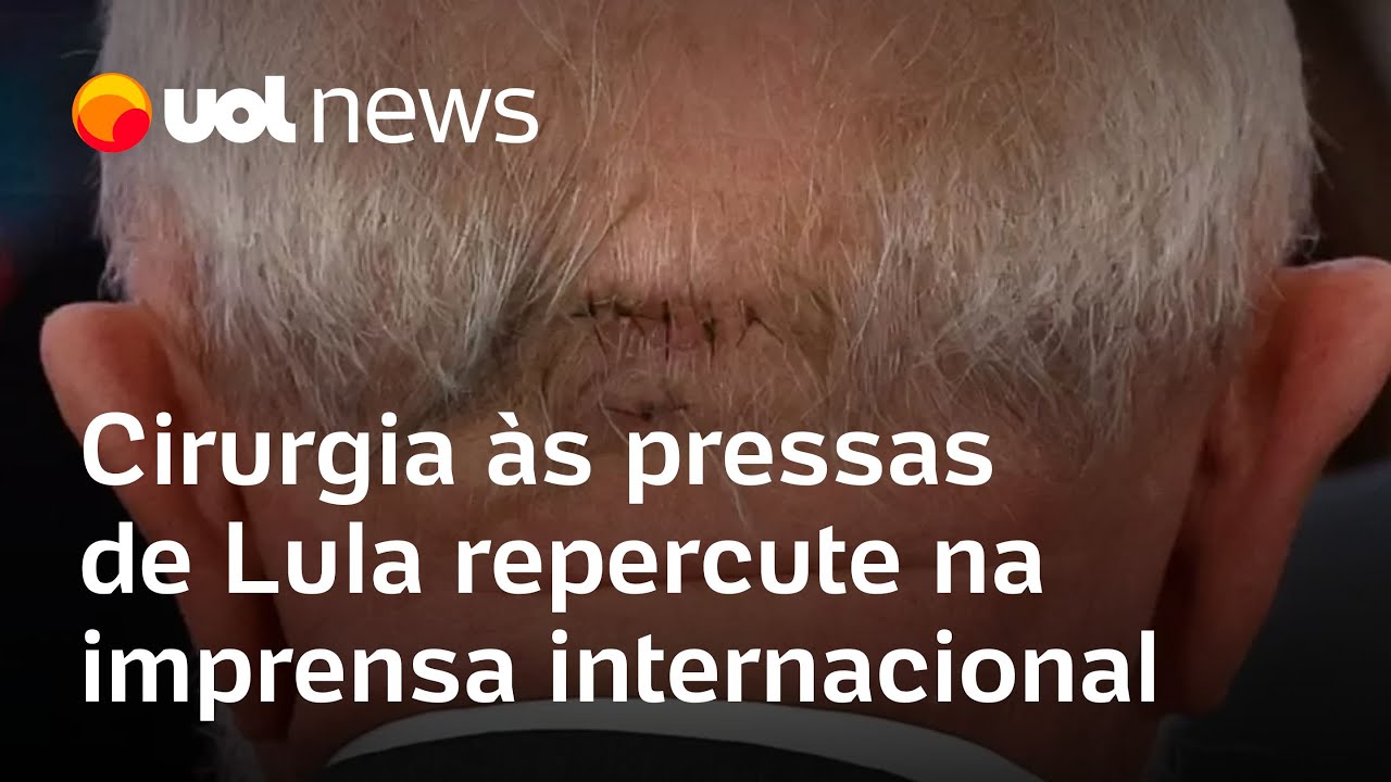 Lula internado: Cirurgia às pressas do presidente repercute na imprensa internacional; veja