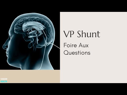 VP Shunt