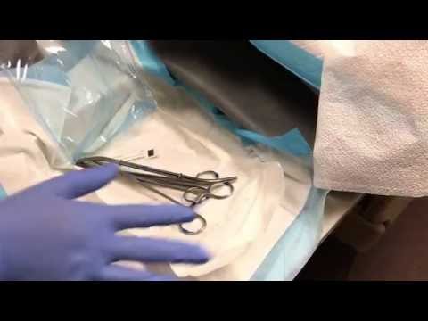 IUD Insertion Training Video