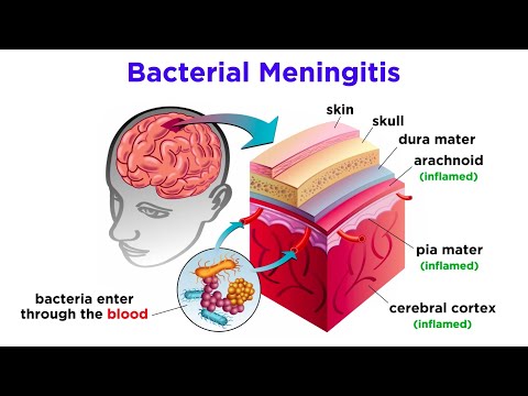 Brain Damage and Neuroplasticity