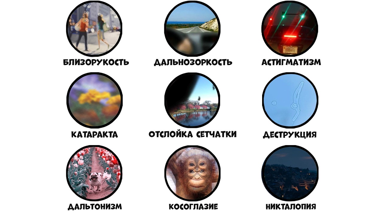 Все дефекты зрения за 9 минут