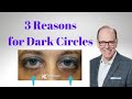 3 Reasons For Dark Circles Under Your Eyes Facial Plastic Surgeon Insight