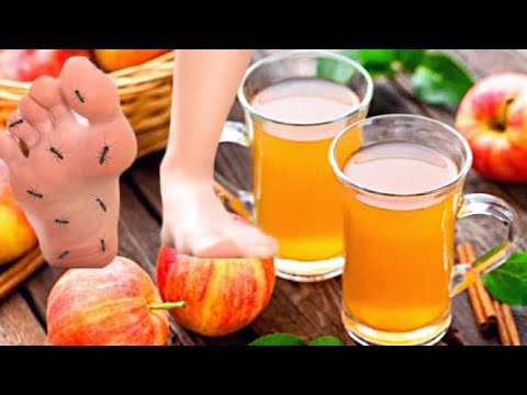 Trnci u rukama i nogama prirodni lek! (RECEPT)