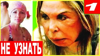 ЖУТЬ!!! ЗВЁЗДЫ после НЕУДАЧНОЙ ПЛАСТИКИ!