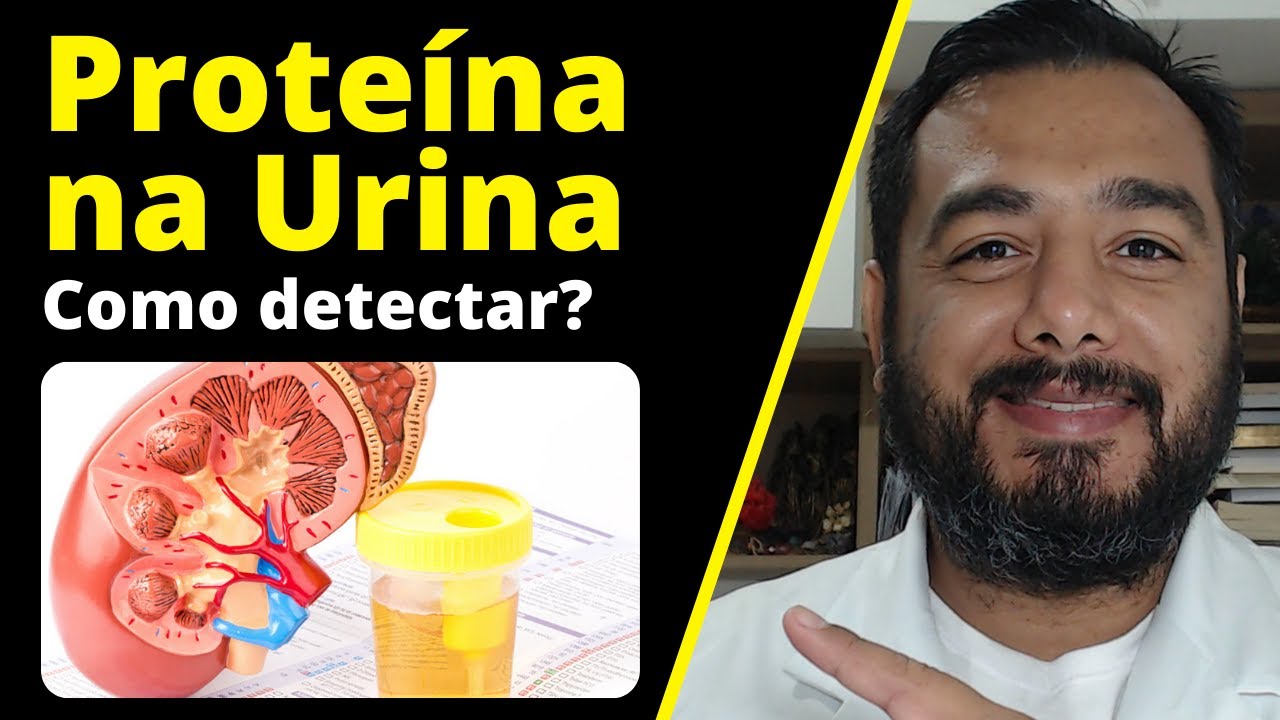 O que causa proteinúria? Qual exame detecta perda de proteína na urina? Microalbuminúria | Albumina