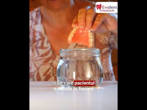 Cui îi este recomandat ALL on 4 sau ALL on 6?