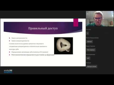 Endo.Education Вебинар Надежды Звягинцевой 'Время-эффективность в эндодонтии'