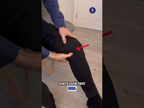 Medial Collateral Ligament (MCL) Self Test! #shorts #mcl