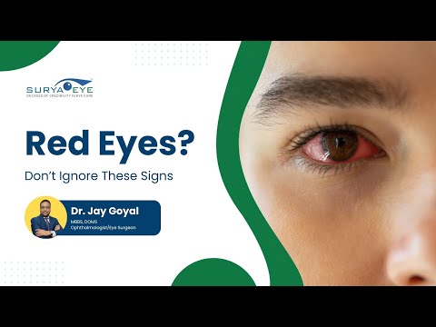Woke Up With a Red Eye? Causes & Remedies Explained by Dr. Jay Goyal