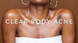 How To Get Rid of BODY ACNE Fast! | ✨Glowy Skincare Routine for Chest & Back✨