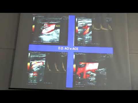 ECO COLOR DOPPLER TSA Dott. Angelo Di Filippo