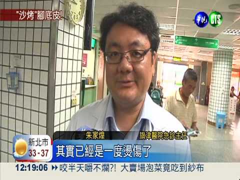 夏日別赤腳踩沙 小心燙到脫皮!