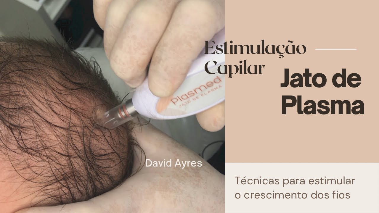 Jato de Plasma na estimulação Capilar