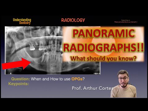 Extraoral Radiographs TUTORIAL: (Dental Panoramic, OPG reading review Dentistry students, Radiology)