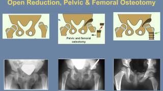 Paediatric Orthopaedic Tutorial