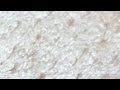 Squeeze perennial blackheads on lips @quyettranofficial3246