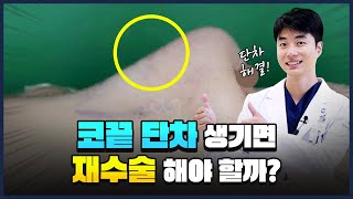 코수술 후 생긴 코끝 단차 해결하는 방법