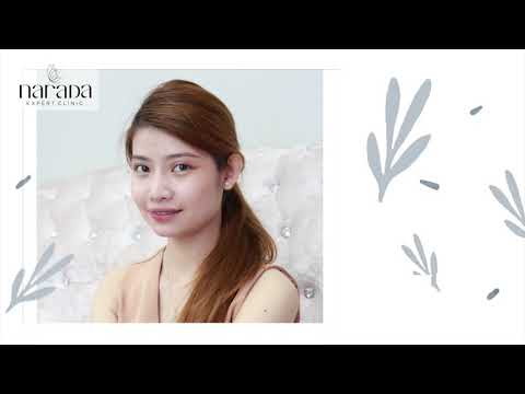 เพิ่มมิติความสวยให้กับใบหน้า ด้วยการเสริมจมูก Smooth Line Nose เทคนิค Semi-Open ที่ นารดาคลินิก เพิ่มมิติความสวยให้กับใบหน้า ด้วยการเสริมจมูก Smooth Line Nose เทคนิค Semi-Open ที่ นารดาคลินิก