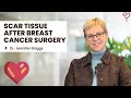 Scar Tissue After Breast Cancer Surgery What You Need To Know