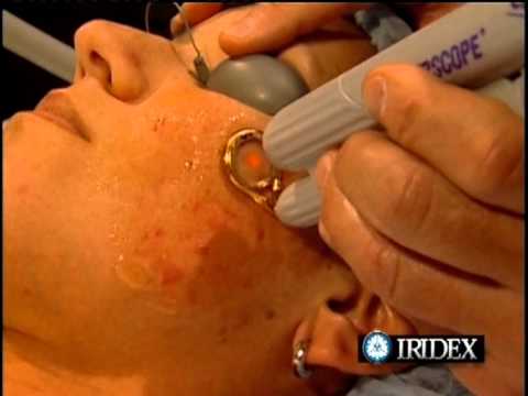 comment traiter boutons visage