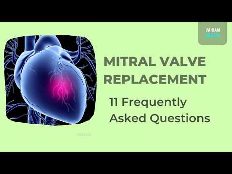 Mitral Valve Replacement - 11 Frequently Asked Questions