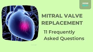 Mitral qopqoqni almashtirish - 11 ta tez-tez so'raladigan savollar